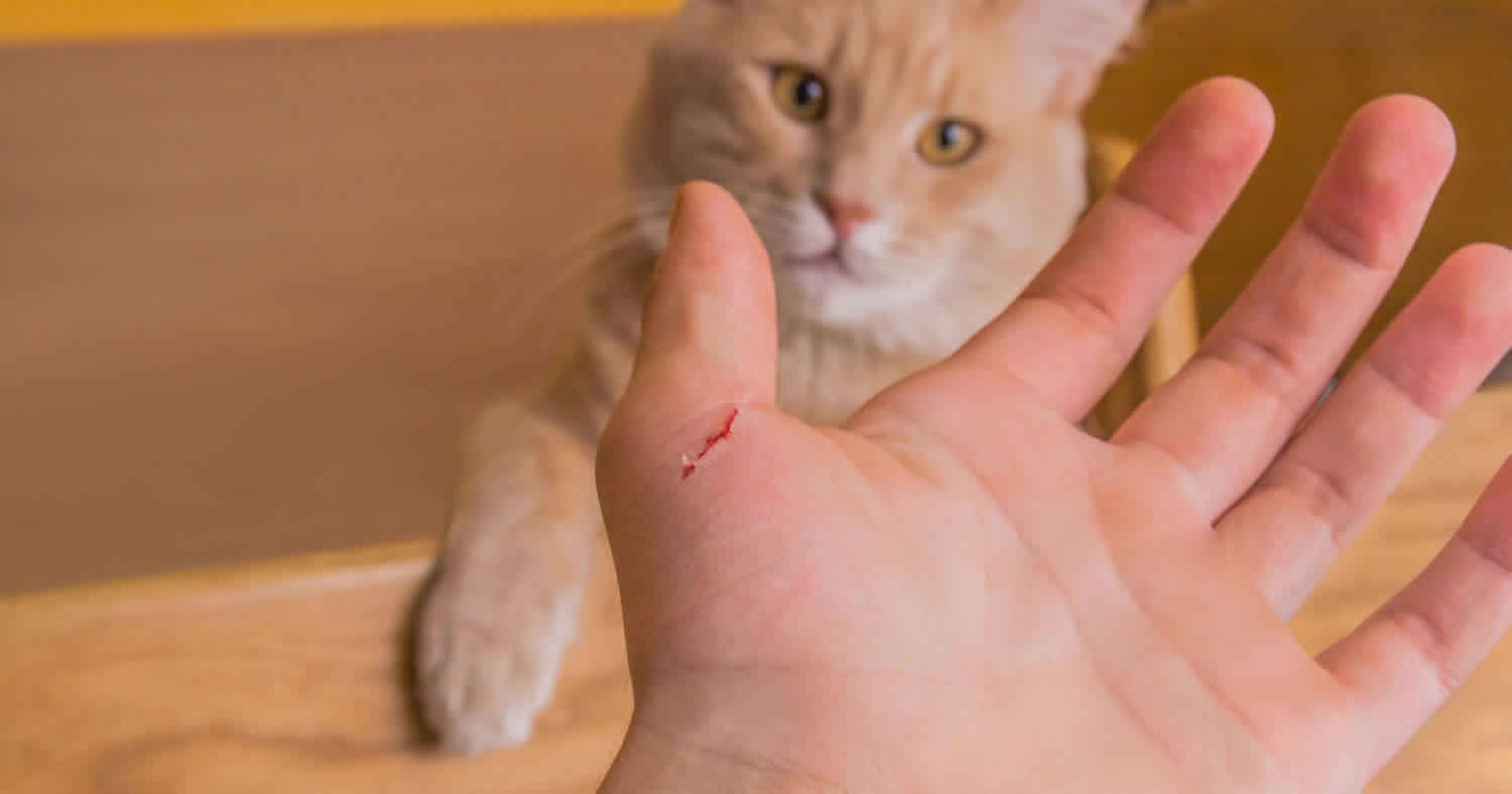 Cat Scratch Fever: Spotting Symptoms & When to Seek Medical Help